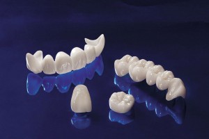 Crowns and Bridges | Family Dental Care